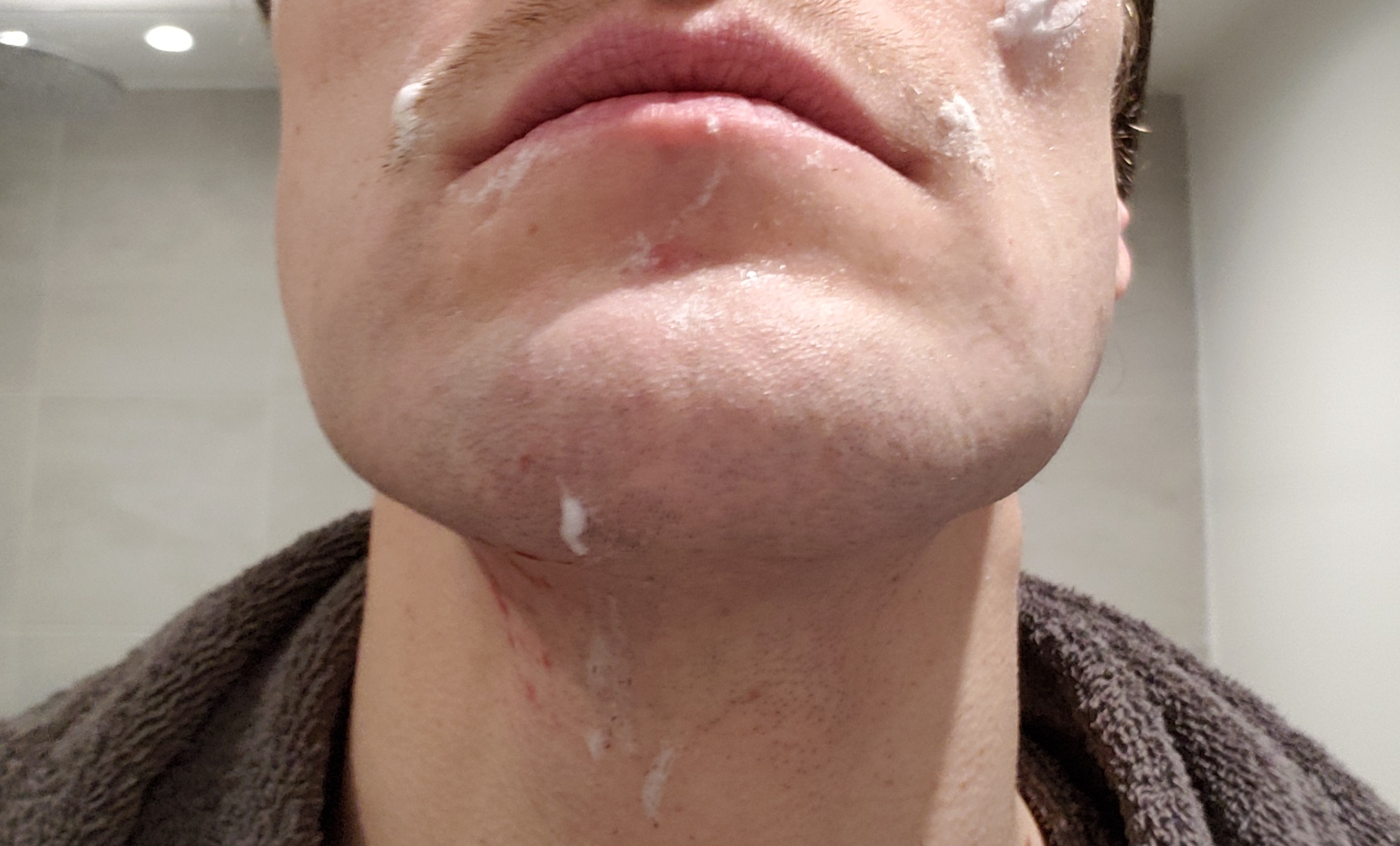 Hoe een gevoelige huid reageert op de Fusion 5 (linkerkant van het gezicht) en de Skinguard (rechterkant). Foto Hans Klis