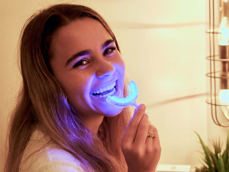 glowup teeth whitening 5