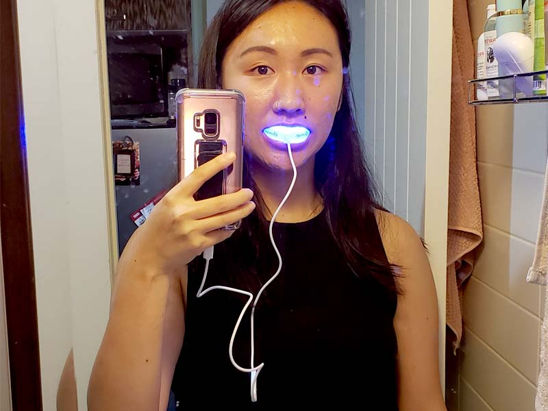 glowup teeth whitening 3