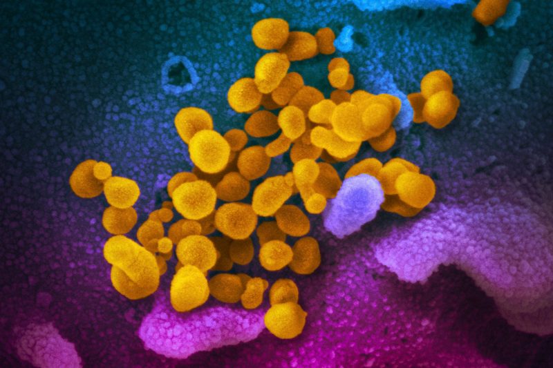 This undated electron microscope image made available by the U.S. National Institutes of Health in February 2020 shows the Novel Coronavirus SARS-CoV-2, yellow, emerging from the surface of cells, blue/pink, cultured in the lab. Also known as 2019-nCoV, the virus causes COVID-19. The sample was isolated from a patient in the U.S. According to a poll from The Associated Press-NORC Center for Public Affairs Research released on Thursday, Feb. 20, 2020, a wide share of Americans are at least moderately confident in U.S. health officials' ability to handle emerging viruses, and more express concern about catching the flu than catching the new coronavirus. (NIAID-RML via AP)