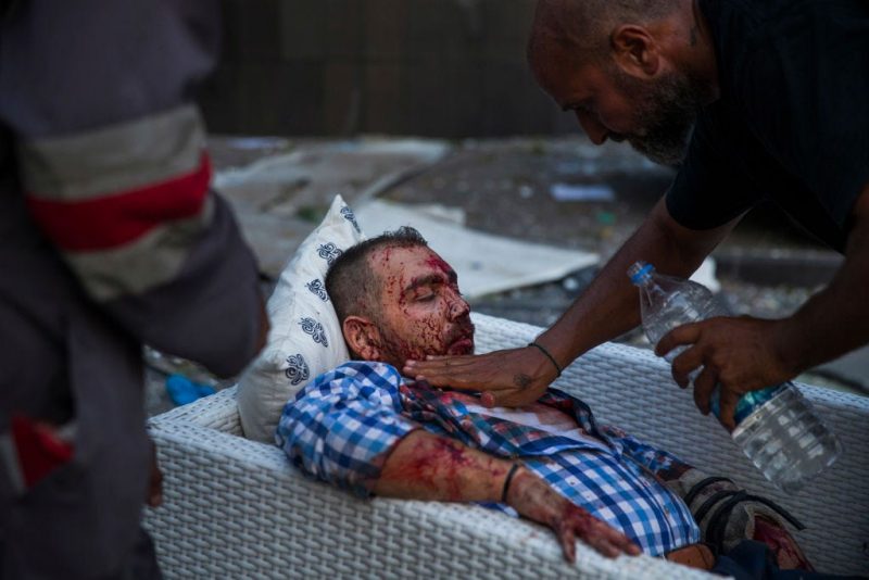 An injured man is treated after a large explosion on August 4, 2020 in Beirut, Lebanon