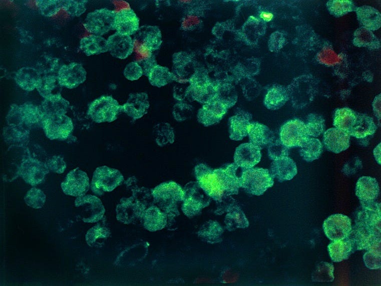 naegleria fowleri amoeba 130815